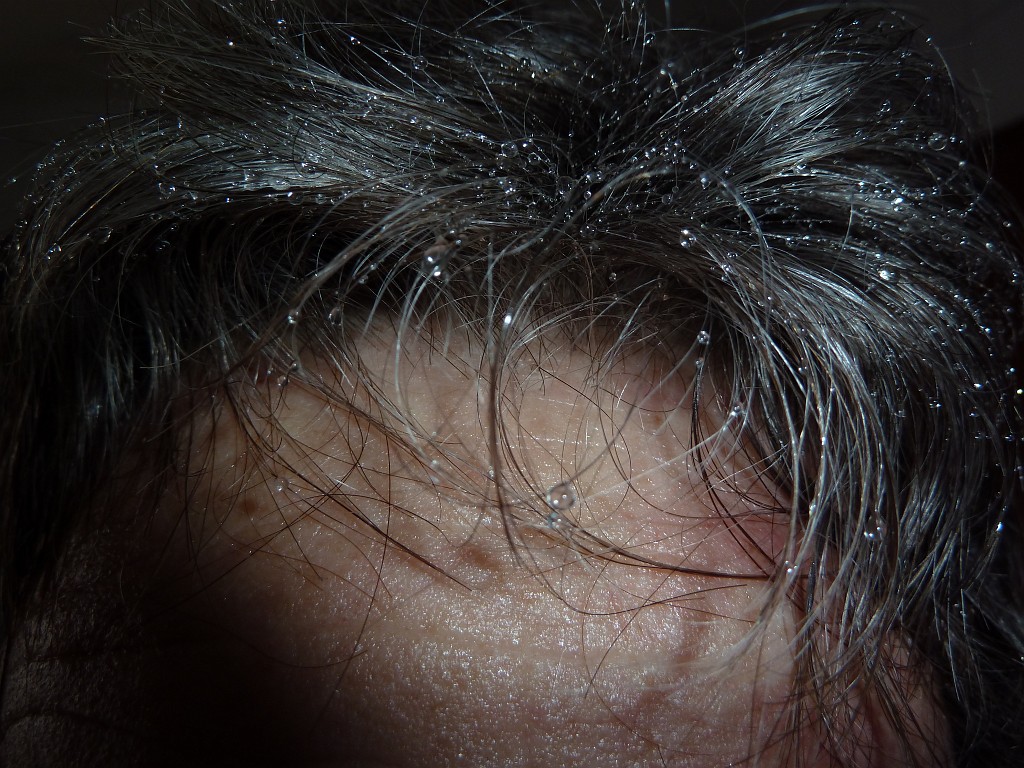 P1020513.JPG - Water drops in hairs